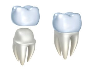 Dental Crowns Orig